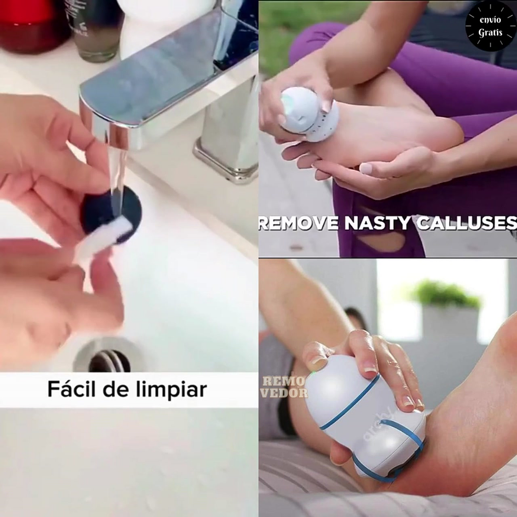 Removedor de Callos